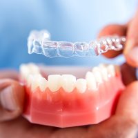 Invisalign for Children